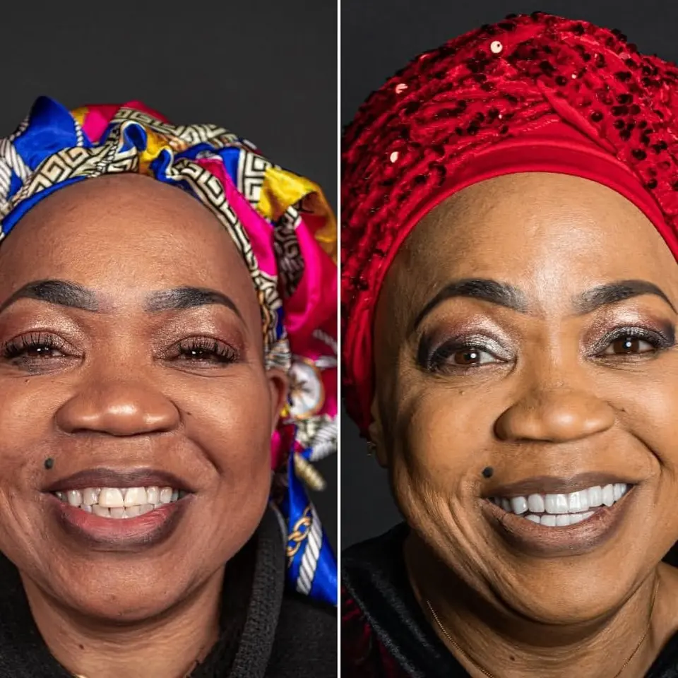 Before and after: Grace, BlueMagic Group Dental patient