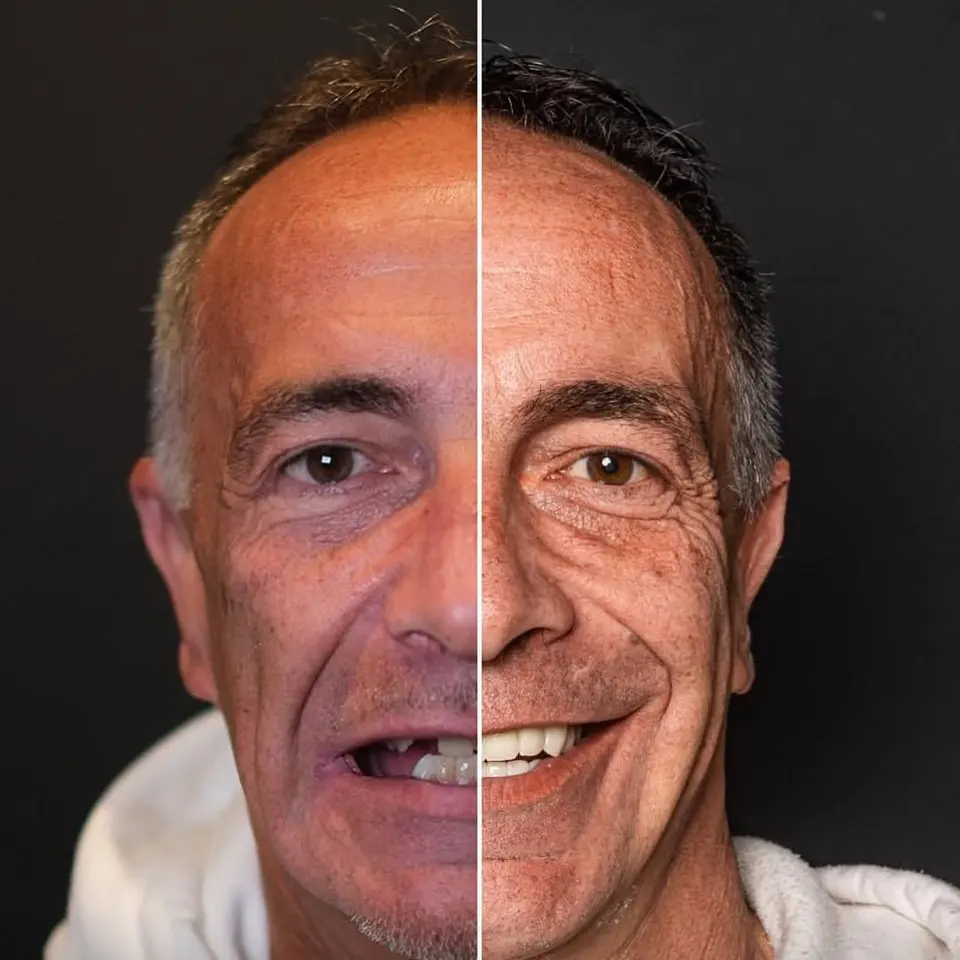 Before and after: Roberto, BlueMagic Group Dental patient