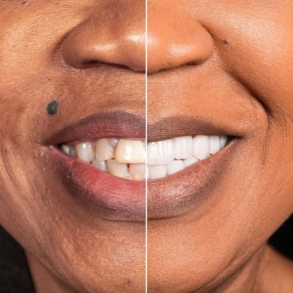 Before and after: Grace, BlueMagic Group Dental patient