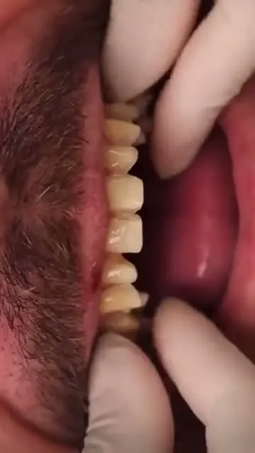 Standbild aus einem Patientenvideo von BlueMagic Group Dental